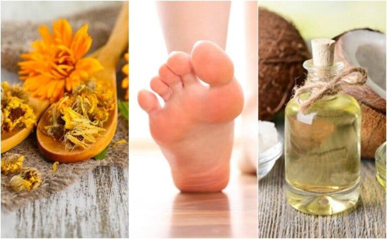 Cómo preparar 5 remedios naturales para las úlceras del pie diabético