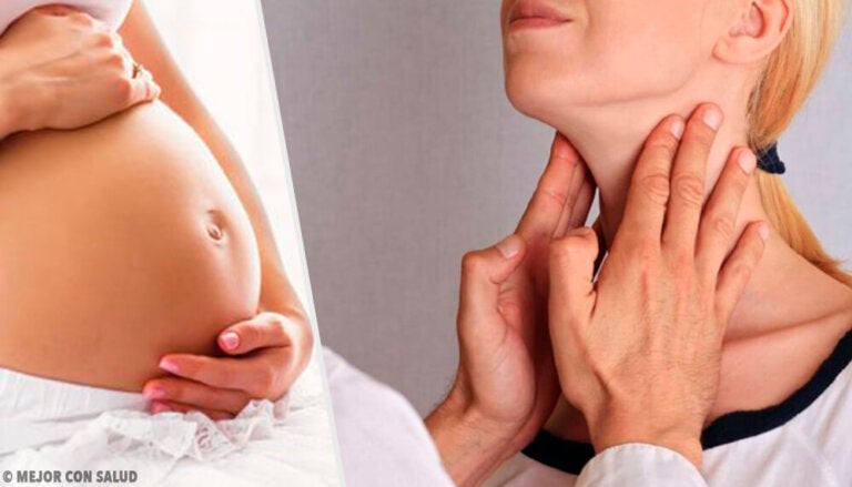 ¿Cómo reducir las molestias del hipotiroidismo durante el embarazo?
