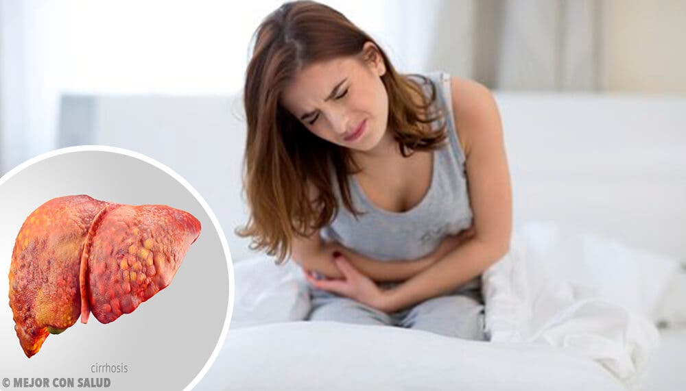 Femme avec hépatite et urine foncée.