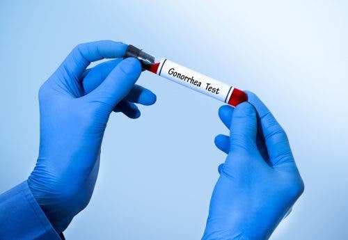 Clínica de la gonorrea