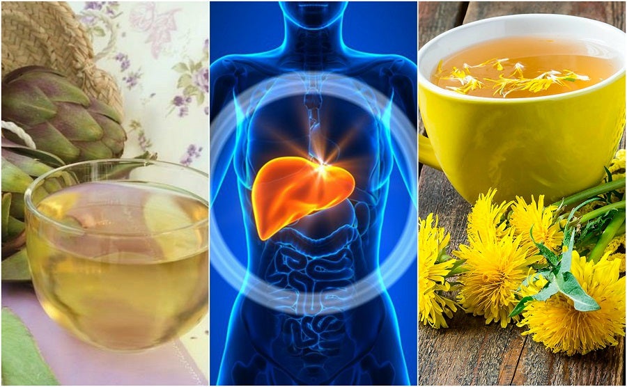 Remedios Herbales para el Hígado Graso: Un Enfoque Natural para la Salud Hepática