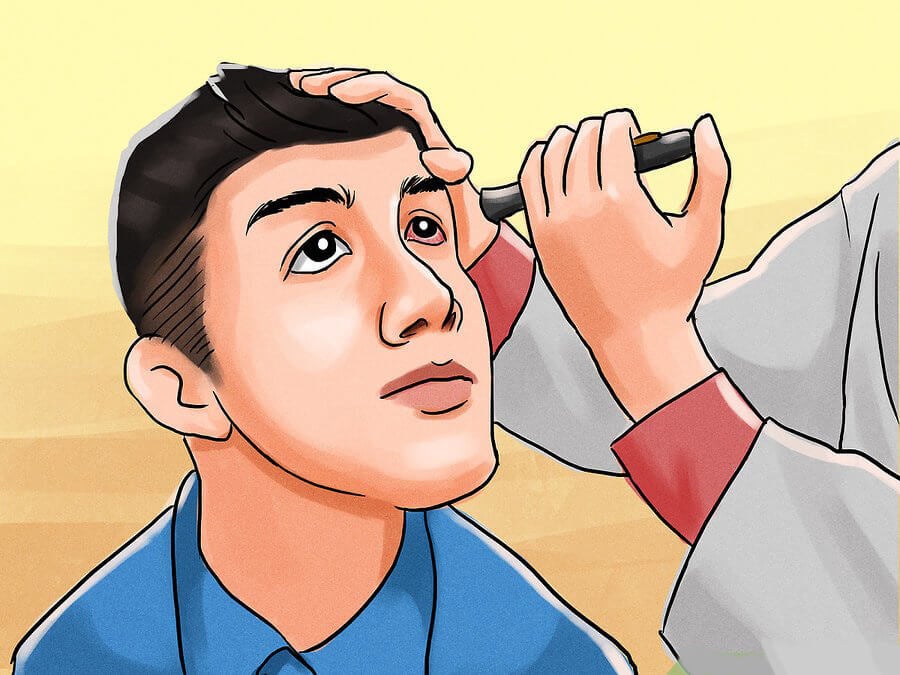Conjuntivitis