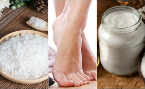 Cómo ablandar los callos de los pies con 5 remedios naturales