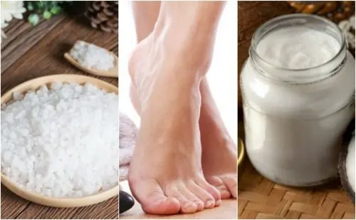 Cómo ablandar los callos de los pies con 5 remedios naturales