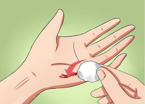 ¿Cómo evitar que se infecte una herida?