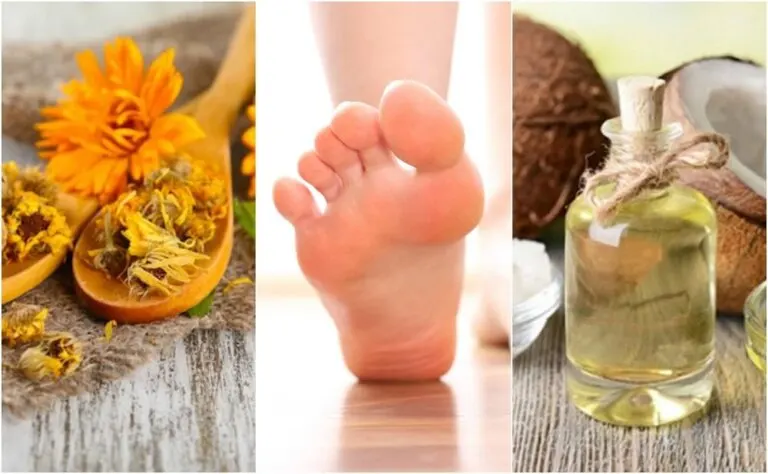 Cómo preparar 5 remedios naturales para las úlceras del pie diabético