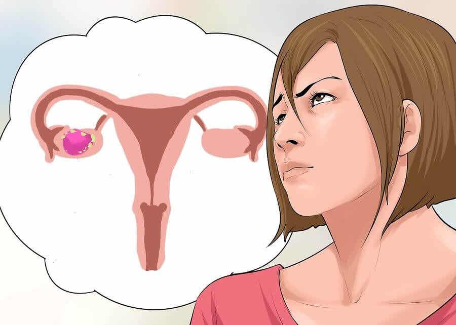 Efectos secundarios del cáncer de ovario