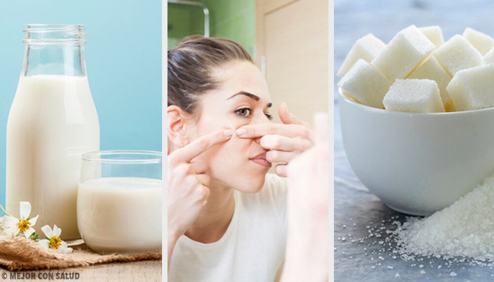 Elimina las impurezas de tu piel con estas 4 mascarillas