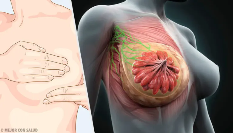 La anatomía de la mama