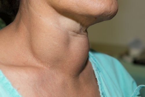 La cirugía como alternativa al tratamiento farmacológico del hipertiroidismo.