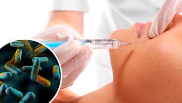 La toxina botulínica, un veneno letal