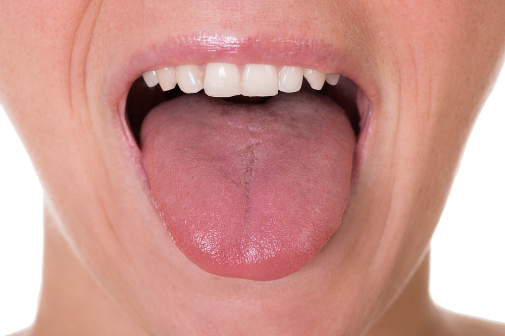 Los 5 primeros síntomas de cáncer de lengua
