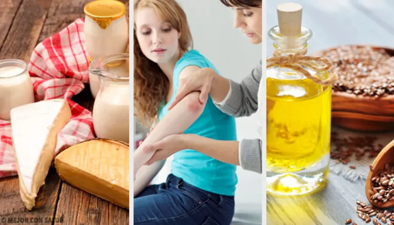 5 tratamientos herbales tópicos para la psoriasis
