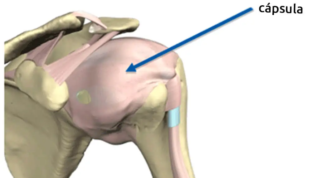 Imagen de una capsulitis