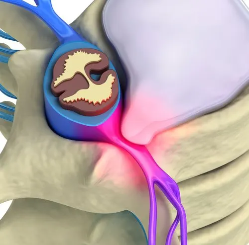 Qué estimulos activan a los nociceptores