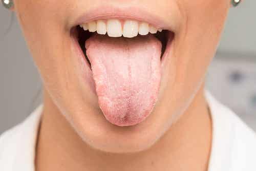 Mujer con la lengua blanca la lengua blanca