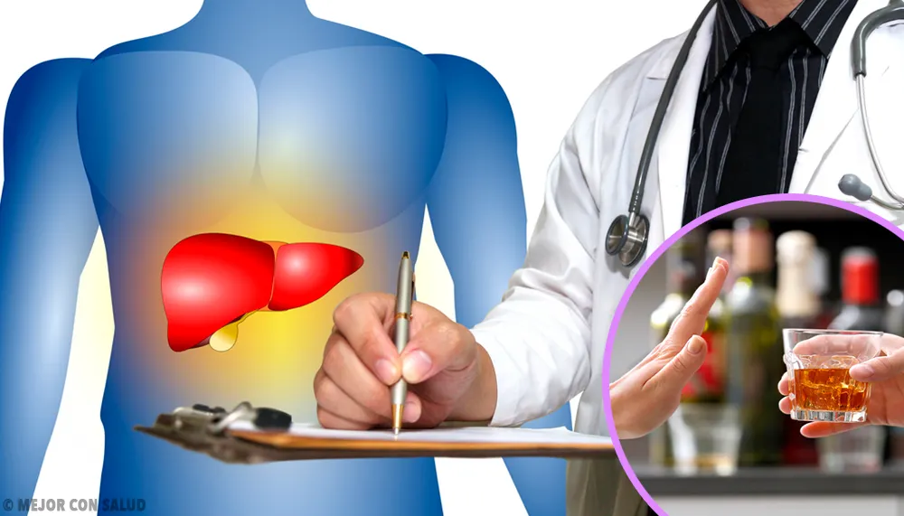 cirrosis como problema del hígado