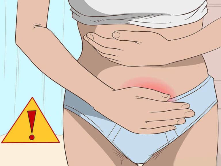 Tratamiento de la cistitis