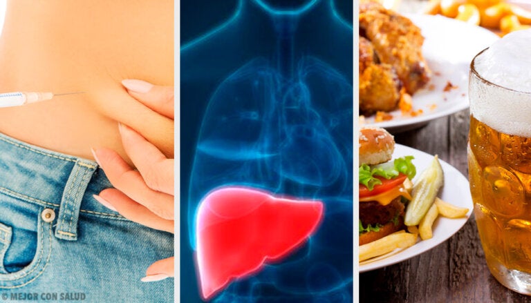 Tratamiento de la esteatosis hepática