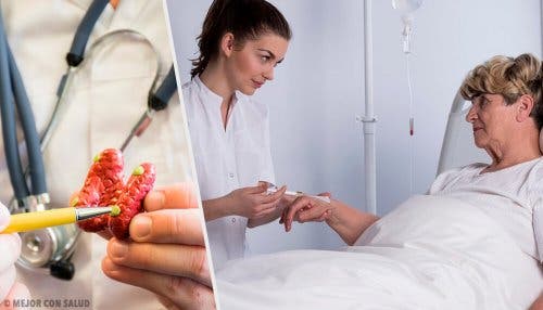 Tratamiento del hipertiroidismo
