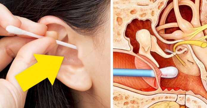 Cómo limpiar los oídos de un niño sin bastoncillos