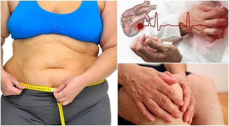 8 riesgos a los que te expones debido a la obesidad