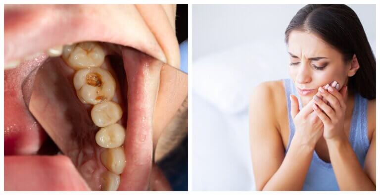 7 síntomas que te alertan de una infección dental
