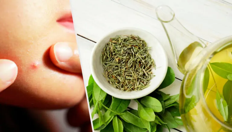 6 tónicos y mascarillas con té verde para combatir el acné