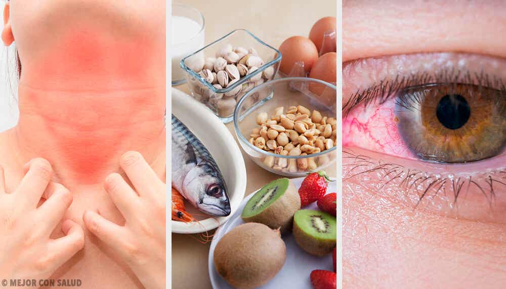 Alergias alimentarias y cómo reducirlas