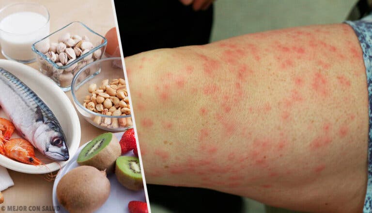 Cuáles son los alimentos alergénicos más comunes