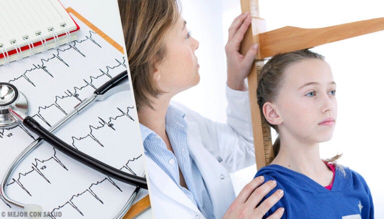 Aspectos acerca del síndrome de Turner