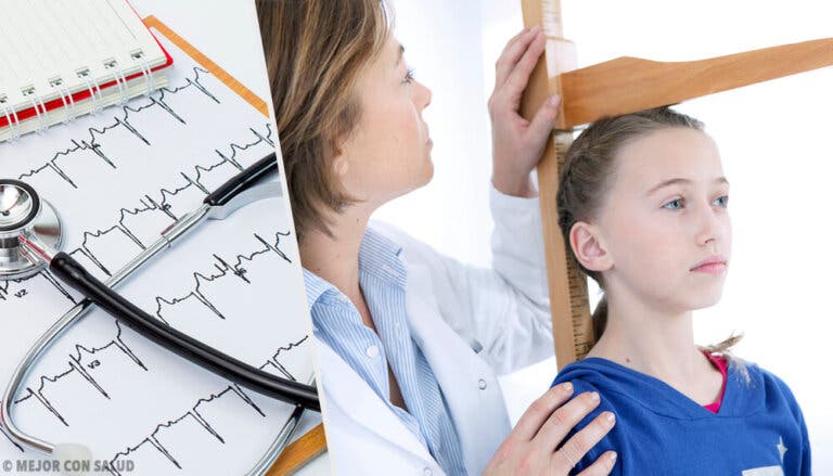 Aspectos acerca del síndrome de Turner