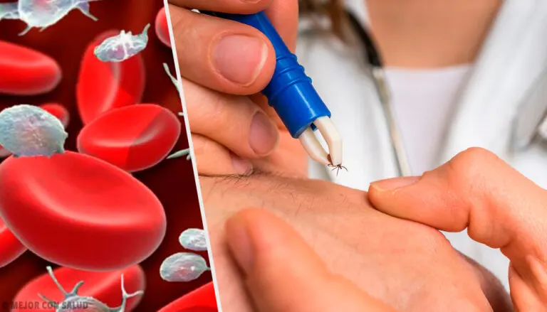 Babesiosis: causas, síntomas y tratamiento