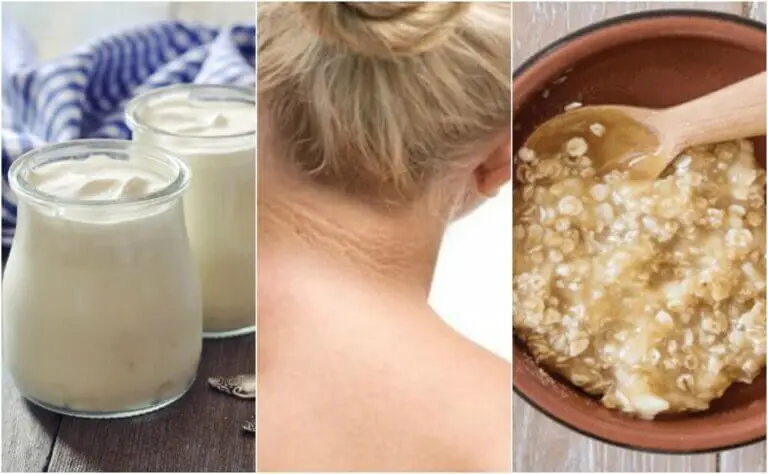 Combate las manchas en el cuello con 5 remedios