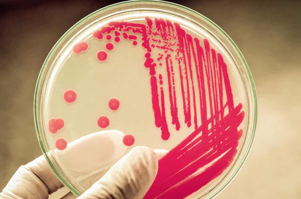 Complications dans l'utilisation des bactéries comme bio-usines