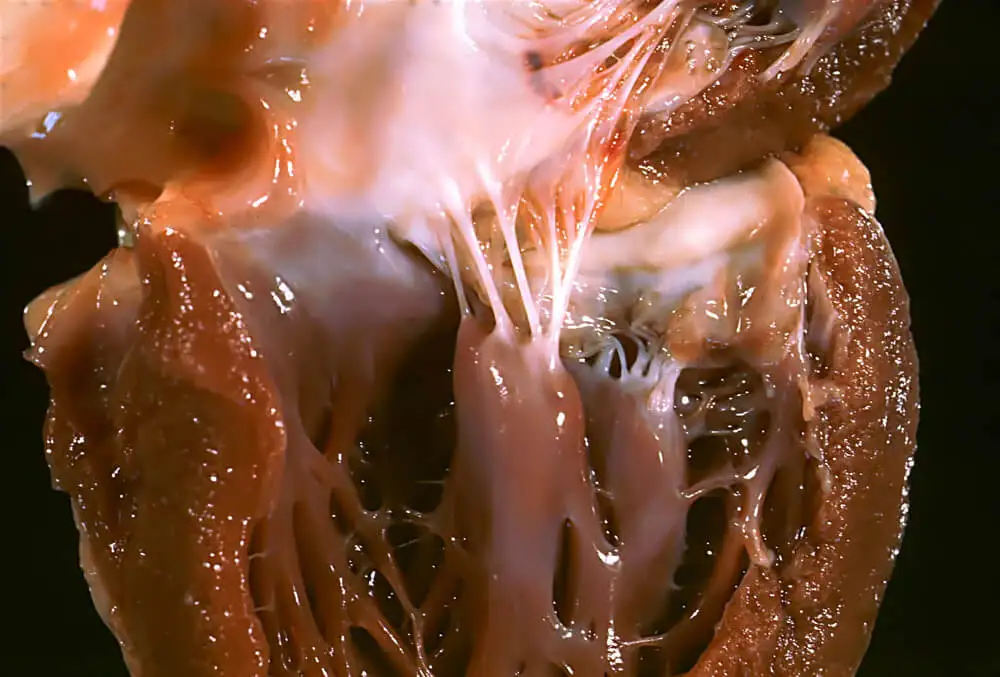 Contracción-muscular-sistole