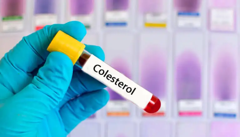 6 remedios de plantas que ayudan en el tratamiento del colesterol alto