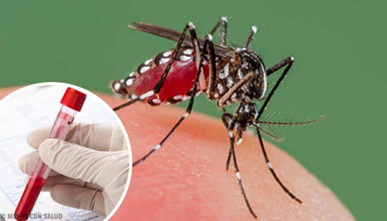El dengue: síntomas, tratamiento y prevención