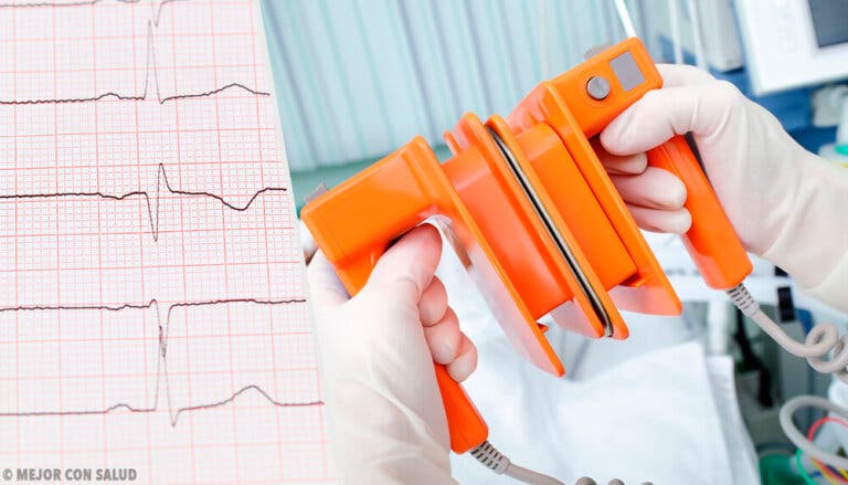 Desfibrilación y cardioversión eléctrica