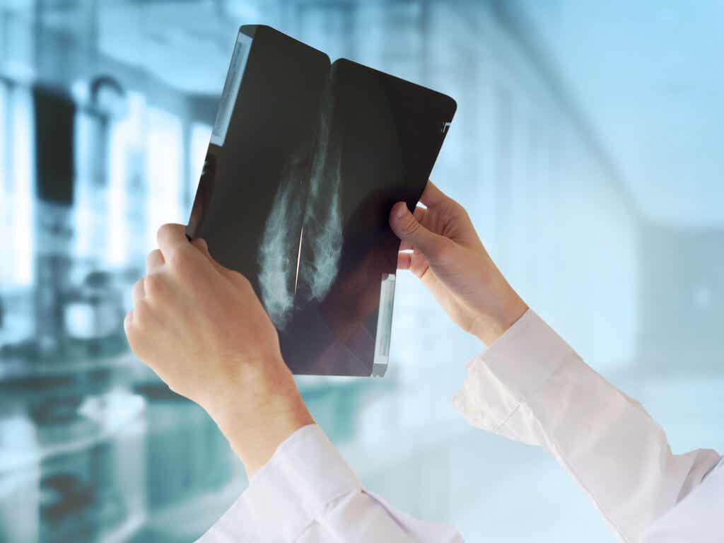 El diagnóstico del secuestro broncopulmonar se puede realizar mediante radiografía.