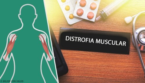 Distrofia muscular de Duchenne