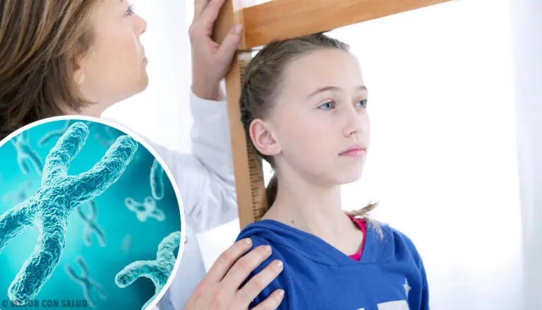 El síndrome de Turner