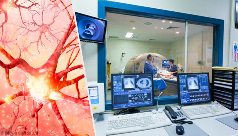 Enfermedad de Alexander