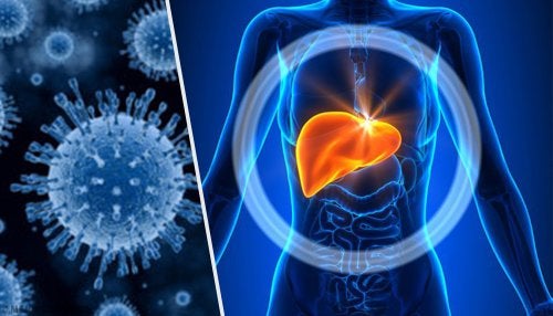 Hepatitis A