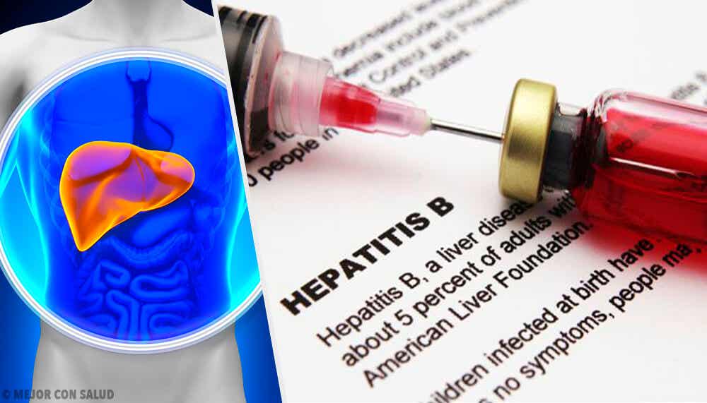 Tratamiento de la hepatitis B