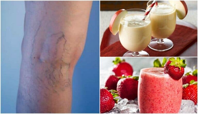 Reduce las varices y los problemas circulatorios con 5 batidos