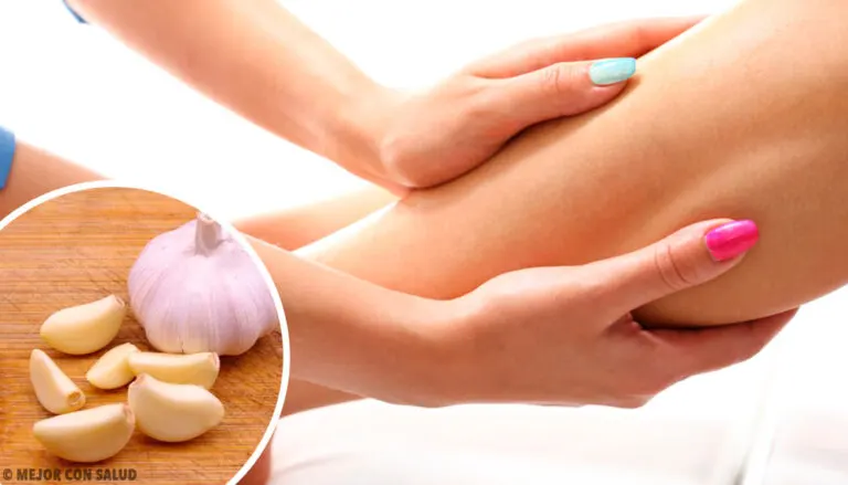 Remedios naturales para reducir edemas