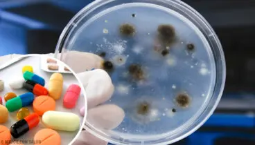 Tratamiento de la aspergilosis