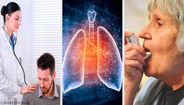 Tratamiento del enfisema pulmonar