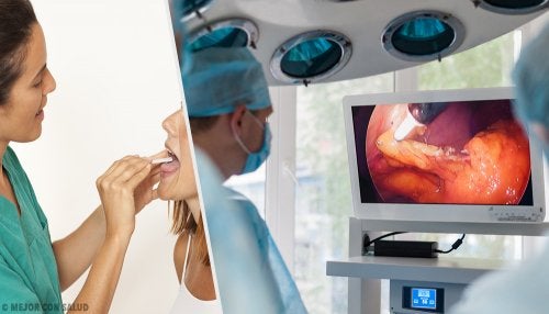 Tratamiento del tumor de células granulares (tumor de Abrikossoff)